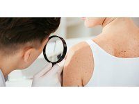 Examen dermatologique