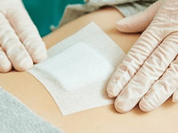 Pansements occlusifs