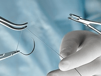 Kits de suture