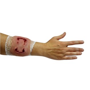 Plaie morsure de chien sur filet