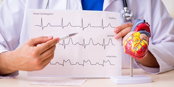 cardiologue