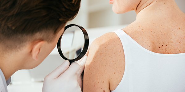 examen-dermatologique