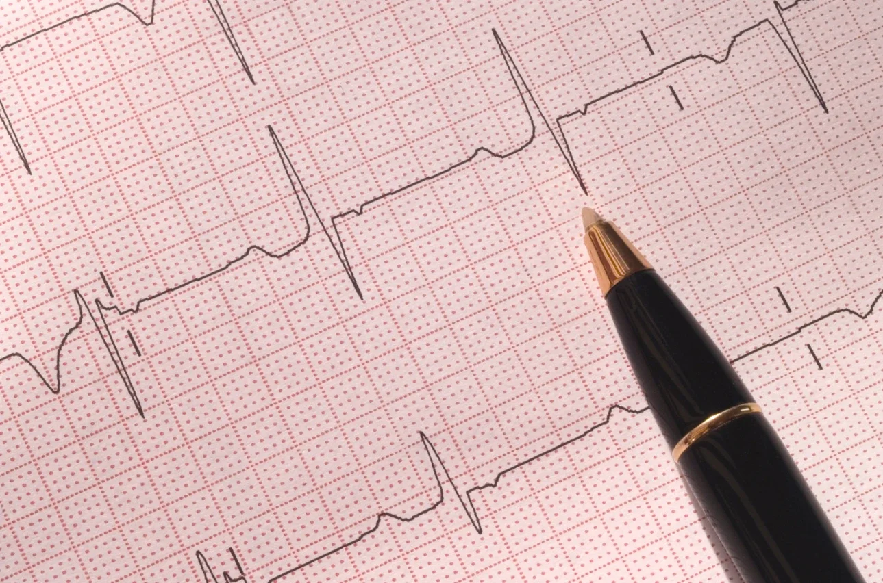 Papier ECG