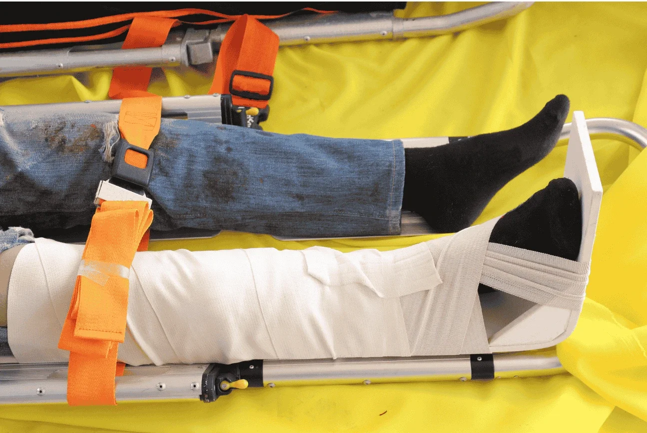 immobilisation par dépression jambe